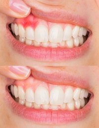 Rapid Repair Gums Serum Effectively Relieve Tooth Allergy Dental Caries Tooth Cleaning Toothpaste Relieve Tooth Damage Drops